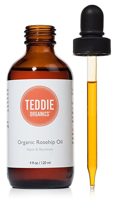 Organic Rosehip Oil – 100% Pure Unrefined and Cold Pressed Rosehip Seed Oil - Best Moisturizer for Face, Hair, Nails - Great for Fine Lines, Wrinkles, Acne Scars, Sun Damage, Stretch Marks – Soothes Dry Skin Conditions Like Eczema, Psoriasis